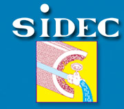 Sidec services, détartrage chimique